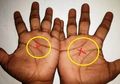 Cek Tangan Anda Apakah Ada Tanda X yang Langka Ini? Inilah Makna Tanda Tersebut