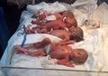 Wanita Irak Ini Lahirkan 7 Bayi Kembar dalam Satu Persalinan dengan Selamat, Jadi yang Pertama di Timur Tengah
