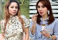 Wajahnya Berubah Drastis, Femmy Permatasari Blak-blakan Soal Operasi Plastik: 'Ini Demi Kesehatan'