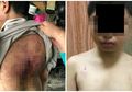 Dipukuli Ibu dan Ayah Tiri dengan Kabel Rice Cooker, Bocah Malang Ini Ditemukan dengan Baju Berlumuran Darah
