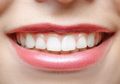 Tebak Karakter dan Sifat Asli Pasangan Lewat Bentuk Bibir, Moms yang Mana?