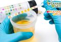Bukan Tanda Sakit, Ini Deretan Makanan yang Bisa Bikin Urine Berubah Warna, #SahabatBuah dan #Sahabat Sayur Harus Tahu
