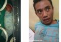 Ibunya Dibunuh, Janin Ini Berhasil Diselamatkan: Berapa Lama Janin Dapat Bertahan Hidup Ketika Ibunya Meninggal?