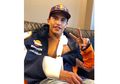 Operasi Marc Marquez Berjalan Lancar, Mungkin Balapan Lagi Awal Agustus