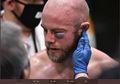Kalah Mengenaskan, Petarung UFC Ini Alami Cedera Mata Mengerikan