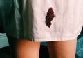 Cara Mengatasi Noda Darah Menstruasi di Pakaian