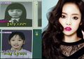 Ternyata Ini yang Akan Dialami oleh Idol Kpop yang Melakukan Operasi Kelopak Mata!