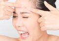 Ikuti 7 Cara Ini Biar Bekas Jerawat Cepat Tersamarkan