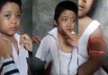 Sekujur Tubuhnya Lebam, Begini Pengakuan Pedih Bocah SD yang Dianiaya Ibunya