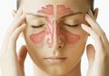 Flu Berkepanjangan Adalah Gejala Sinusitis Yang Bisa Menyerang Anak Muda Juga. Pelajari Yuk!