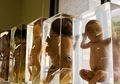 Ini Dia 4 Museum Teraneh dan Paling Nyeleneh, Ada Museum Kematian!