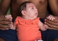 Diduga Terinfeksi Virus Zika, Lebih dari 2.700 Bayi di Brasil Terlahir dengan Otak Kecil