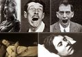 Encephalitis Lethargica, Penyakit Kuno Misterius yang Sangat Mematikan