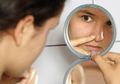 Jerawat Akan Hilang dengan Sendirinya Setelah Seseorang Menikah?
