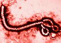 HIV Belum Ada Apa-apanya, Ini 10 Virus Paling Mematikan di Dunia