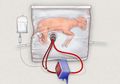 Baru Difungsikan untuk Bayi Kambing, Rahim Buatan Ini Diharapkan Bisa Atasi Persoalan Bayi Prematur pada Manusia