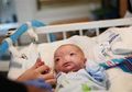 Bayi yang Lahir Tanpa Hidung dan Memikat Dunia Itu Meninggal Tragis pada Usia 2 Tahun