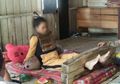 Sudah 2017, Tapi Perempuan Berprestasi Ini Masih Dipasung
