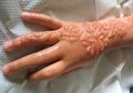 Untuk Para Ibu, Jangan Sampai Anak Gadis Anda Menderita Seperti Ini Gara-gara Henna yang Tampak Cantik Itu
