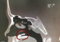 Gara-gara Ada yang Tumbuh Sembarangan Hidung Wanita Ini Sering Alami Pendarahan