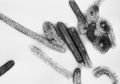 Sudah Tewaskan 3 Orang, Inilah Penjelasan Virus Marburg yang Mirip dengan Virus Ebola