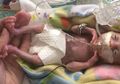 Diberi Label ‘Bayi Paling Prematur yang Pernah Ada’, Bayi ‘Ajaib’ Ini Berhasil Tumbuh Sehat