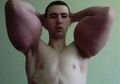 Malas Pergi ke Gym, Kirill Suntikkan Minyak Sintesis ke Lengannya Agar Terlihat Seperti Popeye