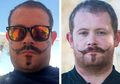 Pria Ini Mendadak Punya Luka Berbentuk Kumis Gara-gara Ditato dengan Henna