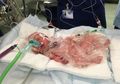 Ajaib! Bayi Ini Mampu Bertahan Hidup Meski Terlahir dengan Jantung Tumbuh di Luar Tubuh