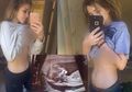 Tengah Hamil 6 Bulan, Namun Perut Wanita Ini Masih Rata, Kok, Bisa? Ini Penjelasannya!