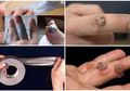 Wow! Cukup Dengan Lakban Kutil di Kulit Anda Akan Hilang, Bisa Dicoba Sekarang Juga