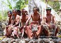 Di Desa Ini Sunat Bukan Hanya Demi Kejantanan, Tapi Juga Menghindari Bentuk Bibir Keturunannya Tebal dan Menggantung