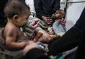 (Foto) Tragisnya Nasib Anak-anak yang Diserang Gas Beracun di Perang Suriah