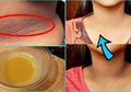 Alami Masalah Kulit Gelap? Jangan Khawatir, Tuntaskan Dengan Bahan Rumahan di Bawah Ini