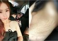 Berbeda dari Ibu Lainnya, Ibu 4 Orang Anak Ini Bangga dengan Stretch Mark di Perutnya dan Menganggap Perutnya Bukan Masalah!