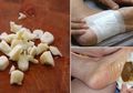 Tempelkan Kain yang Dibasahi Air Bawang di Telapak Kaki Sebelum Tidur, Ini yang Akan Terjadi Pada Tubuh Anda