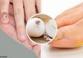 Langsung Bisa Dipraktikkan, Hilangkan Kapalan di Tangan dan Kaki dengan Bahan-bahan ini!
