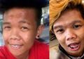 (Foto) Dibully 'Babang Tamvan' di Filipina, Pria Ini Putuskan Operasi Plastik, Hasilnya? Para Wanita Ngantre!