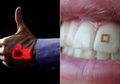 7 Penemuan dalam Bidang Kesehatan Paling Luar Biasa Tahun 2018: dari Vaksin Antikanker hingga 'Update' Memori Otak!