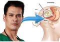 Kerabat : Dr Ryan Thamrin Sudah Lama Mengidap Kanker Otak