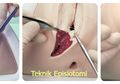 Kiat Melahirkan Normal Tanpa Perlu Jahitan di Vagina