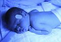 Benarkah Ibu Menyusui Bisa Sebabkan Penyakit Kuning Pada Bayi?