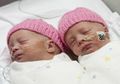 Cara Merawat Bayi Kembar yang Lahir Prematur