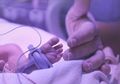 Duh, Bayi Prematur Ini Meninggal Setelah Dokter Tak Sengaja Melukai Kepalanya Saat Operasi Caesar