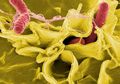 Bakteri <i>Salmonella</i> Modifikasi Berpotensi Jadi Pilihan Alternatif untuk Pengobatan Kanker