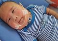 Mengenal Trisomy 13, Penyakit Langka yang Diidap Adam Fabumi
