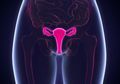 Mengenal Penyebab Kanker Serviks Pada Wanita Usia Muda