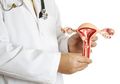 Prediksi 2018: Benarkah Kanker Serviks akan Menghilang di Tahun 2018? Ini Penjelasan Dokter