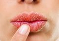 Duh, Lipstik Sudah Cantik tapi kok Ada Bintik Putih di Sekitar Bibir? Coba deh Segera Hilangkan dengan Bahan Alami Ini