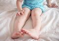 Bila Si Kecil Mengalami Biduran, Obati dengan 5 Cara Mudah Berikut